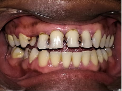 Before-Dentisteria 2