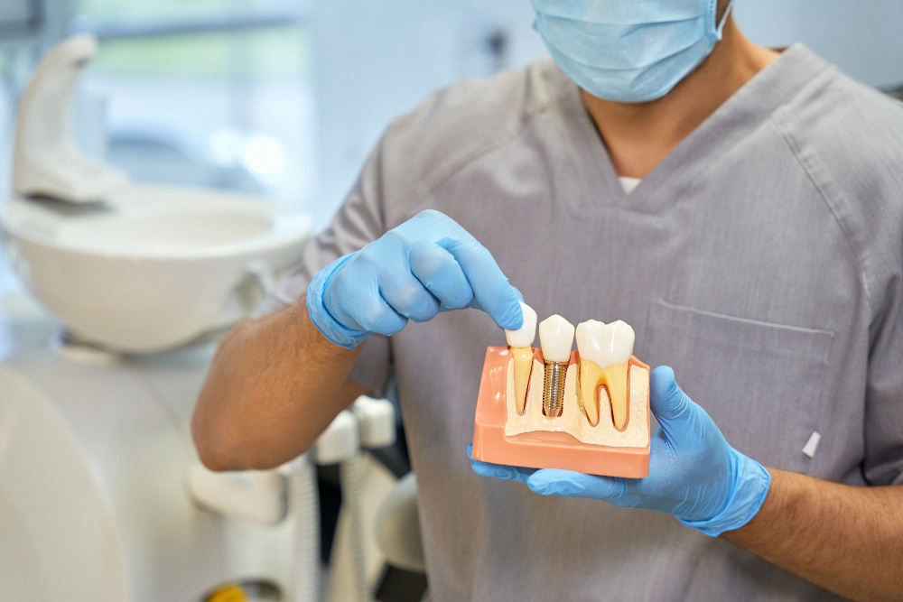 Implantes dentários uma solução duradoura para a perda de dentes